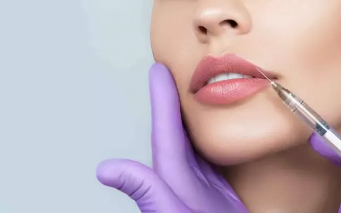 Gold Coast Glow-Up: Key Considerations Before Lip Fillers